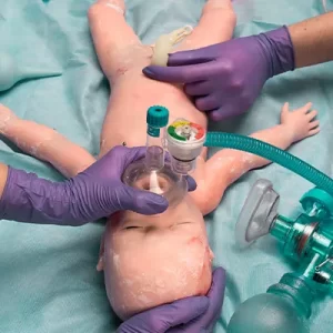 Corso ECM di Simulazione Avanzata "Rianimazione Neonatale in Sala Parto"